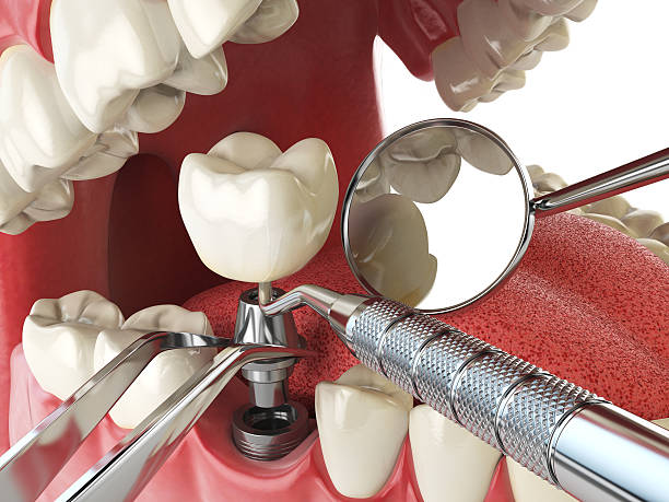 Best Emergency Treatment for Jaw Pain or Injury in Sturgeon, PA